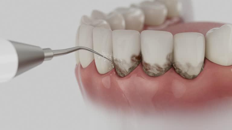 Trusted Teeth Whitening service in Virginia Gardens, FL - Dentist Open Now